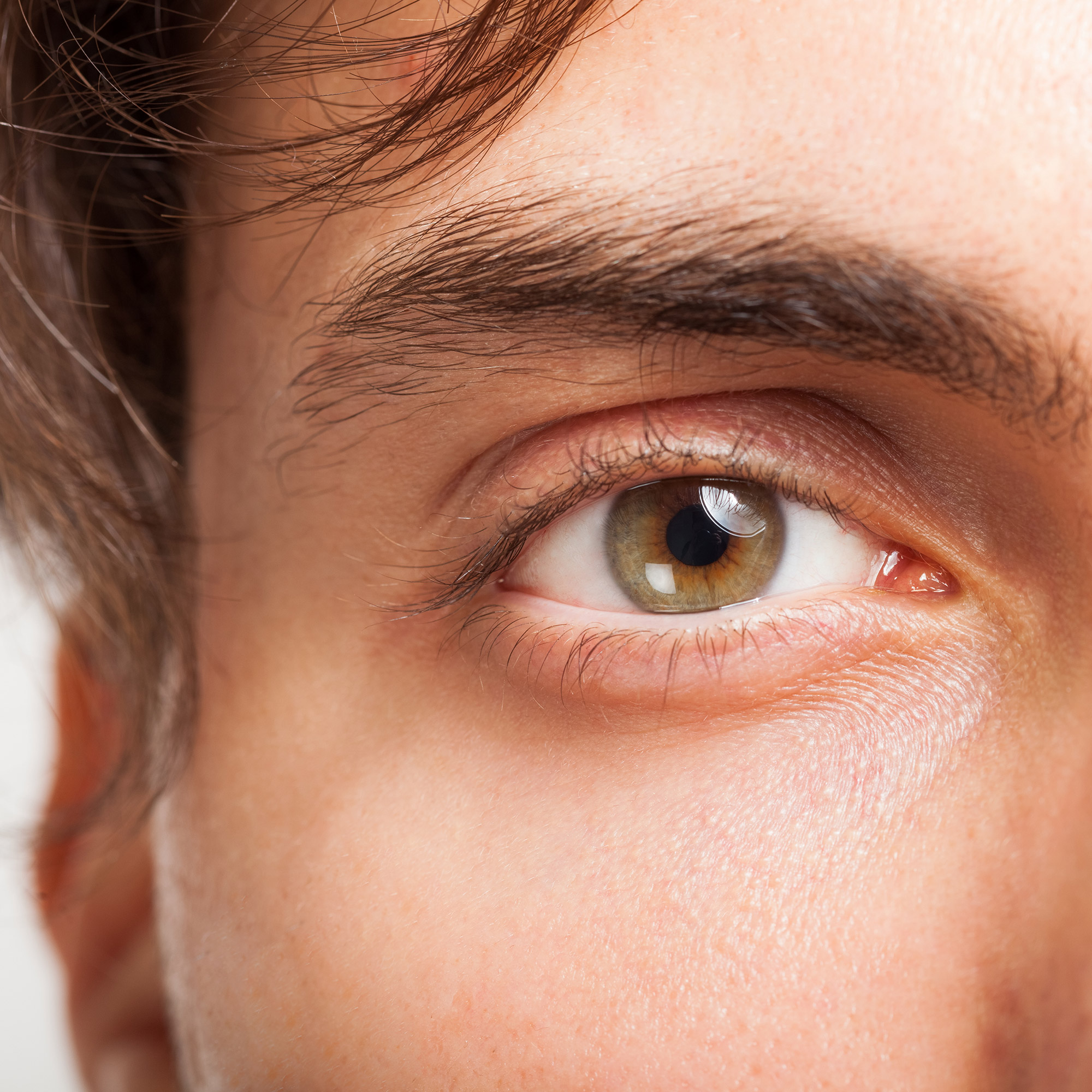 Male Eye | William Samson | NYC Eyelid Surgery